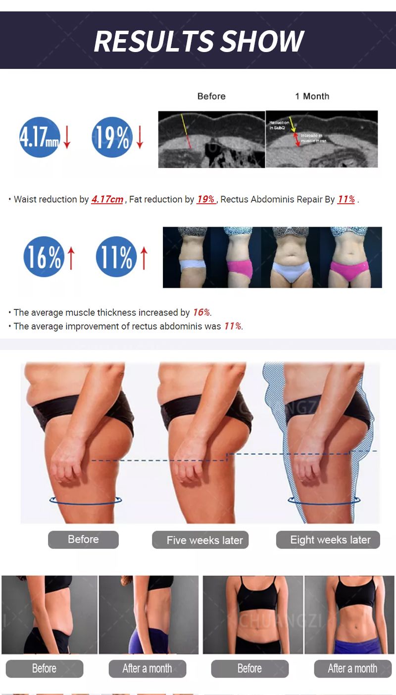 EMS Body Sculpt Muscle Stimulate Machine Electric Slimming