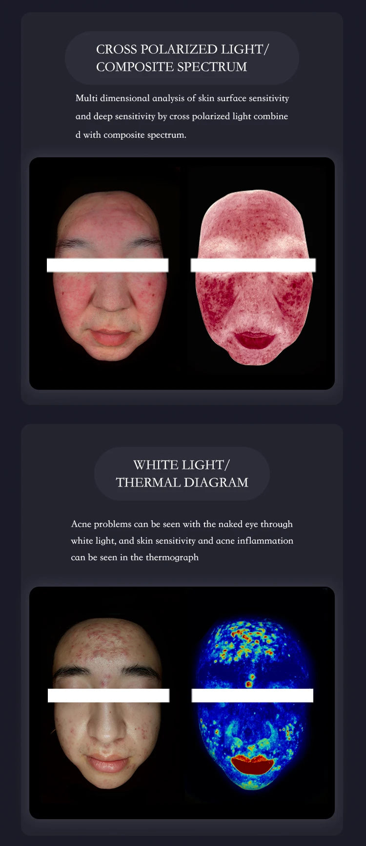 3D AI Facial Skin Analyzer Detection Skin Problem Diagnosis 8 Spectrum Professional Analysis Beauty Salon Equipment