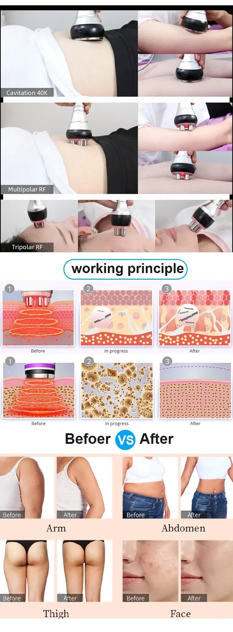 New 4 In 1 Ultrasonic Body Care Tool